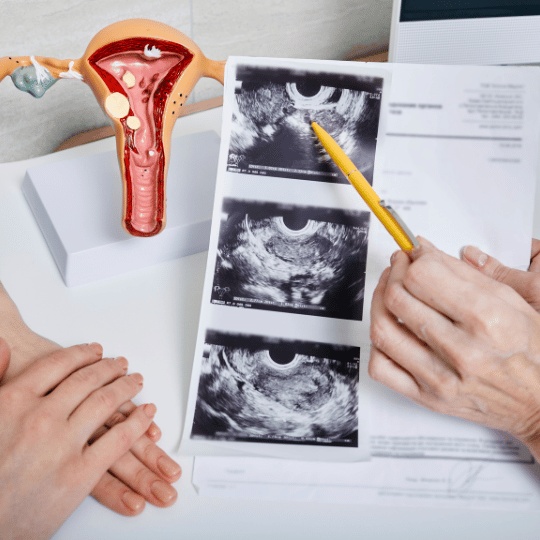 Gynaecological Cancers